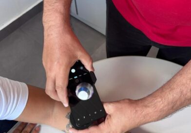 Dermatologia: Telediagnóstico amplia acesso e identifica casos de câncer de pele em MS