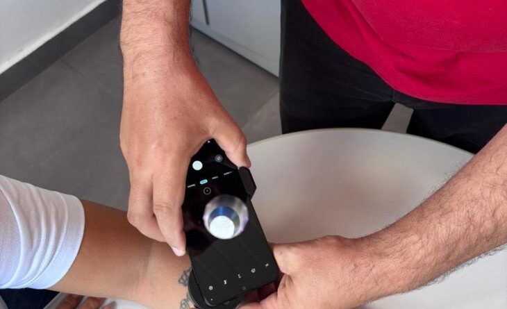 Telediagnóstico em dermatologia amplia acesso e identifica casos de câncer de pele em MS