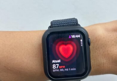 Wearables: Cardiologista da Cassems comenta sobre monitoramento contínuo no pulso
