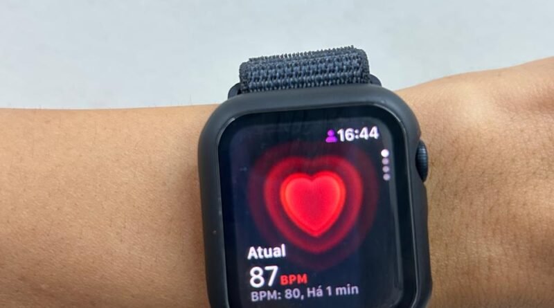 Wearables: Cardiologista da Cassems comenta sobre monitoramento contínuo no pulso